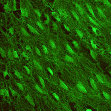 Plectin - Mouse Aorta