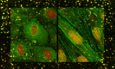 Transcriptional Profiling